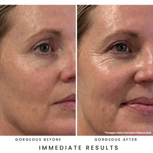 Before and after comparison of a woman's face with text indicating 'Gorgeous Before' and 'Gorgeous After' with 'Immediate Results'.