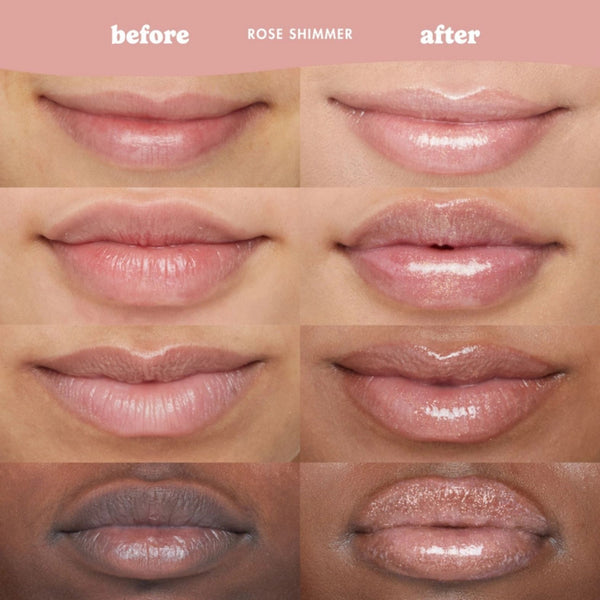 Eight close-up lip comparison panels labeled 'before' and 'after' with the text 'ROSE SHIMMER' at the top, showing a glossy rose-toned lip color effect on different skin tones.